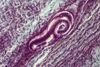 V Česku se po dvou letech objevil nebezpečný parazit - Novinky