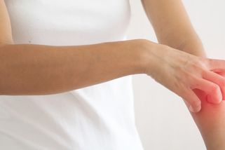 ŽENA-IN - Zákeřný svrab není vzácným onemocněním, ale "řádí", bohužel, i dnes. Dermatoložka radí, jak ho poznat a léčit