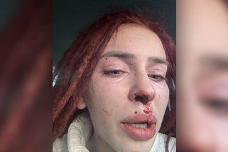 Slovenská miss přiznala opakované domácí násilí: Známý moderátor ji zkopal, zmlátil a zdemoloval byt - Super.cz