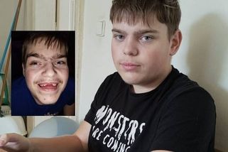 Tadeáš z Ústí trpí autismem, přišel o zuby. Můžete mu vrátit úsměv
