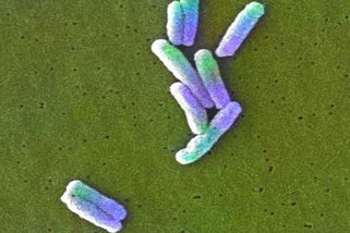 Lidé šetří a málo ohřívají vodu, počty nakažených legionellou jsou rekordní - Novinky