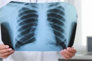 Kdo chodí preventivně k lékaři, dostane peníze, plánuje vláda - Seznam Zprávy