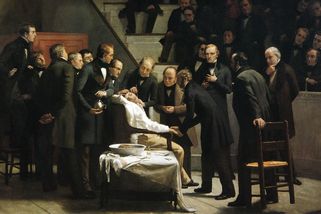 „Nyní mi měřte čas, pánové!“ U počátků anestezie stála i rekordně rychlá amputace - Médium.cz
