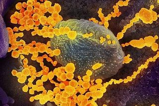 Co vše se už ví o nové mutaci covidu Kraken: Příznaky, intenzita šíření i rizika