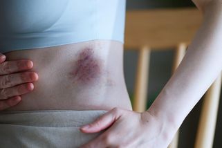 Pravdivé příběhy: Naše láska měla všechno. I krev a modřiny. Zažijte zpověď Veroniky