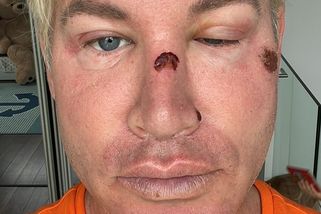 Český Ken skončil po zásahu policie v krvi. Obličej na maděru ukázal na videu. Všemu přihlížel jeho malý syn - Super.cz