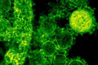 Pneumokok a meningokok mrzačí a zabíjí děti, rodiče přesto váhájí s očkováním - Médium.cz
