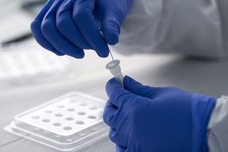 V Brazílii objevili novou mutaci. PCR testy ji nemusejí vždy odhalit - Seznam Zprávy