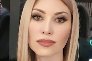 Bývalá královna krásy má po nepovedeném faceliftu znetvořený obličej, nemohla ani zavřít oči. Snímky jsou šokující - Super.cz