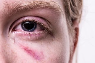 Volal mi mladší syn: Tati, bráchu kopají do hlavy a mlátí mu hlavou o obrubník - Médium.cz