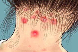 FIBROMYALGIE: Zrádné onemocnění, jehož příznakům až 97 % lidí nevěnuje dostatečnou pozornost. Lékařka proto objasnila, které jsou nejběžnější a na co si dát hlavně pozor