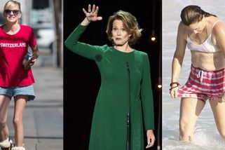 Slavné a (ne)dokonalé. Koho trápí akné, a koho celulitida? - Proženy.cz