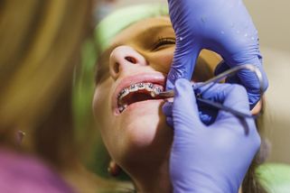 Sedmdesát tisíc? Ceny rovnátek děsí rodiče, zvažují i splátky - Novinky