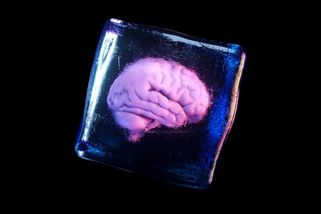 Němečtí vědci zmrazili mozkovou tkáň na -196 stupňů a po rozmrazení opět funguje