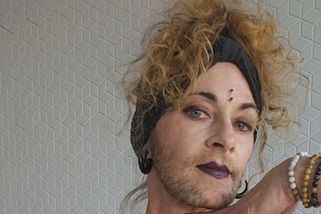 Lidé se jí smějí kvůli bradce