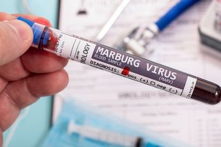 Drastický, smrtící, ale s klíčovou slabinou. Expert popisuje virus Marburg - Seznam Zprávy