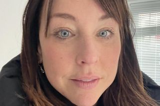 Svobodné matce říkali, že vypadá unaveně: Operace za 76 tisíc mě omladila o 10 let, myslí si. Ukázala fotky před a po - Super.cz