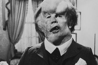 Sloní muž se dočká hned několika nových zpracování