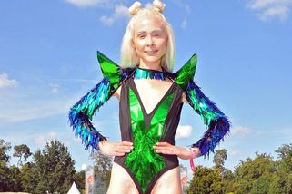 Modelka utratila téměř 4 miliony za operaci prodloužení nohou. Bývalý jí řekl, že musí být vyšší, aby ji mohl milovat - Super.cz