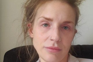 Žena po 28 letech nechala pití. Po dvou měsících abstinence vypadá neuvěřitelně - Super.cz