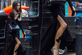 Victorii Beckham z šatů vykouklo stehno. Jako nohy mojí babičky, mohla se dočíst