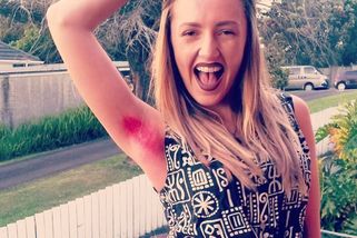 Žena se už 10 let neoholila, chlupy v podpaží si i barví: Muži se mnou kvůli tomu nechtějí randit, stěžuje si - Super.cz