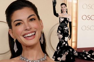 Co si to udělala s obličejem? zalapali lidé po dechu, když uviděli Anne Hathaway