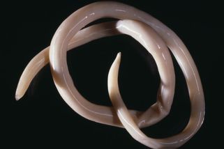 Nebezpečného parazita vykašlal pacient v Nitře. Na kliniku šel původně se srdečními problémy