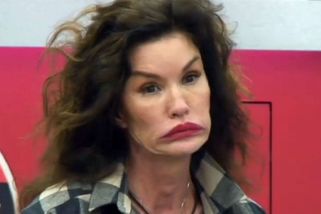 Topmodelka Janice Dickinson žaluje televizi: Při natáčení si nevratně poškodila obličej!