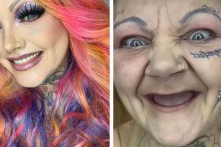 Lidé si myslí, že jsem feťačka, protože nemám zuby, říká hvězda internetu. Když vyndá protézu, sledující zírají - Super.cz