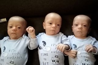 Chtěla druhé dítě, povedla se jednovaječná trojčata. Zachránila je speciální operace - Novinky