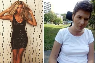 Na diskotéce do ní vrazili a mozek se jí zalil krví. Zdravotníci ji poslali domů