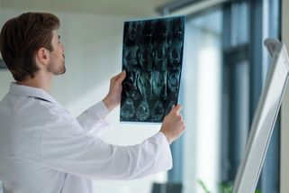 Máte rakovinu? Data ukazují, kde vás začnou léčit nejdříve a kde si počkáte - Seznam Zprávy