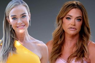 Denise Richards detailně předvedla šokující změnu po faceliftu. Doktor jí ubral 20 let. Vylepšil jí i ušní lalůčky! - Super.cz