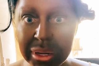 Matka smíchala několik samoopalovacích krémů, aby získala sexy opálenou pleť. Výsledek vyděsí i ty nejotrlejší - Super.cz