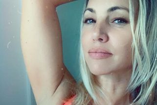 Američanka chtěla být dokonalá: Prasklý silikon jí ale prosakoval do těla a skončila na vozíku - Super.cz