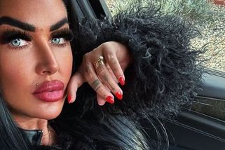 Marie Růžičková se setkala s diskriminací. Kvůli svému vzhledu si nenašla práci