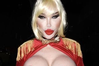 Jessica Alves po rozpuštění výplní v obličeji: Královně plastik měl poslední zákrok vrátit přirozenost. Nezadařilo se - Super.cz