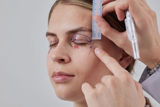 Přemýšlíte o operaci horních víček? Vyzkoušely jsme ji na vlastní oči! Fotky mluví za vše...