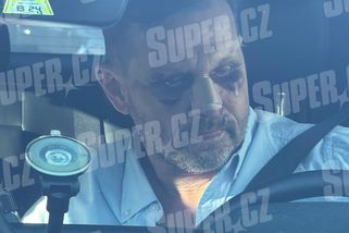 VIDEO: První záběry po bitce s Dopitou. Soukup má úplně rozbitý obličej, Agátin manžel ho hrozivě zřídil - Super.cz