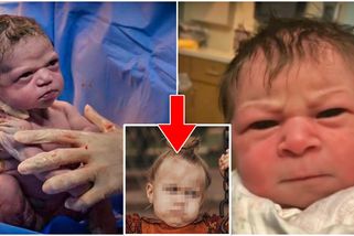 Holčička se narodila s nevrlým výrazem ve tváři. Když ji doktor spatřil, vybuchl smíchy. Podívejte se, jak vypadá dnes. Její fotografie baví celý internet (FOTO)