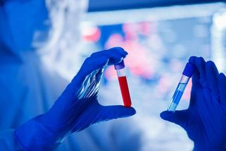 Vědci z Wu-chanu objevili nový koronavirus. Má se šířit rychleji a být smrtelnější - Novinky