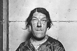 Těžký osud Mary Ann Bevan: Z krásky největší ošklivkou světa a atrakcí v obludáriu - Médium.cz