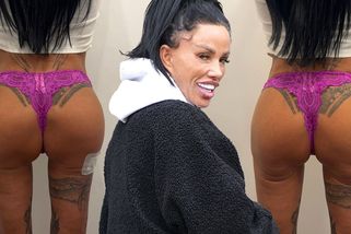 Katie Price si nechala zvětšit zadek: Do hýždí jí vstříkli 50 injekcí výplní