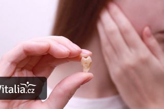 Osmičky vyndá jakýkoliv zubař, lepší je ale jít za specialistou. Nově si ho vyhledáte online