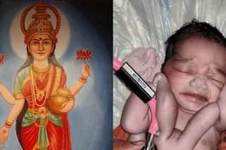 Dítě se narodilo se čtyřma rukama a čtyřma nohama. Indové věří, že jde o reinkarnaci bohyně Lakšmí