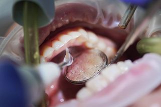 Mladá zubařka dostane milionovou dotaci a zachrání pacienty v Děčíně