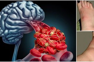 Nohy mohou hlásit riziko infarktu nebo mrtvice: Zde je test na jejich detekci, tyto jasné příznaky rozhodně nepřehlížejte!
