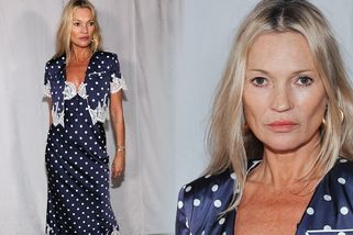 Šílené, strašidelné oči a propadlé tváře. Kate Moss tipují o deset let víc!