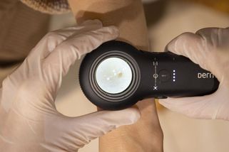 Lidem v lékárnách kontrolovali kůži. A každého třetího odeslali k lékaři - Seznam Zprávy